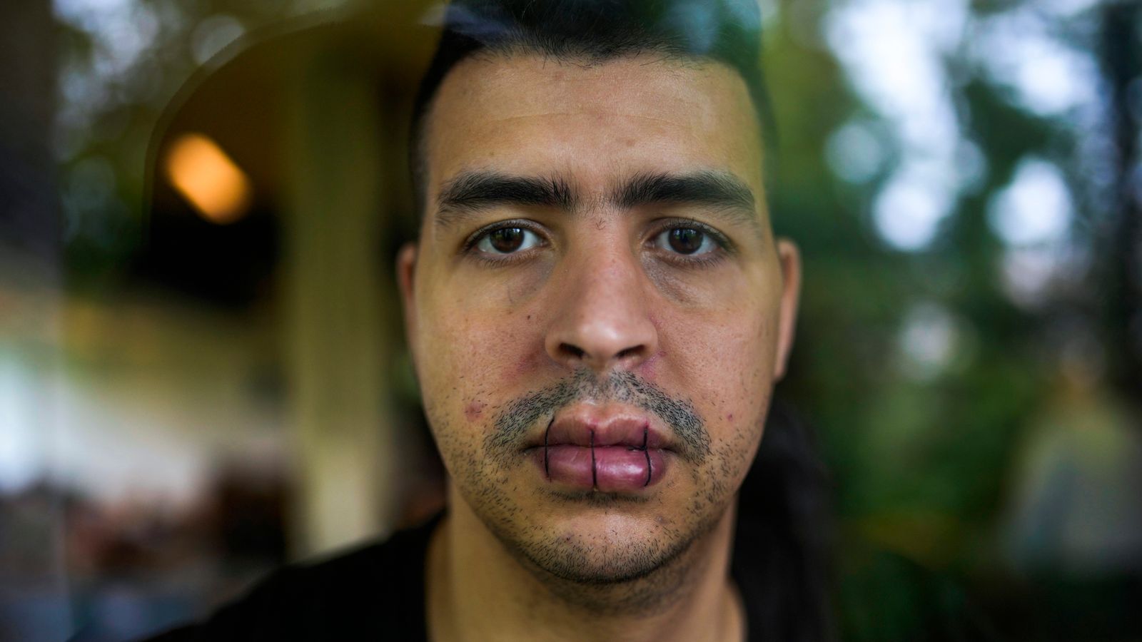 Belgium: Hundreds Of Migrants Go On Hunger Strike With Some Stitching Their Mouths Shut