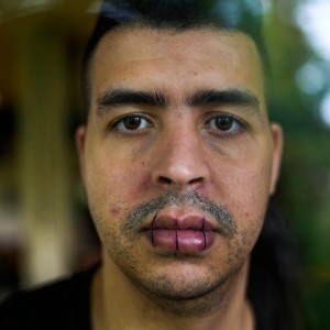 Belgium: Hundreds Of Migrants Go On Hunger Strike With Some Stitching Their Mouths Shut