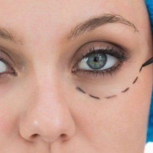 experts-claim-that-remote-work-and-social-media-are-behind-the-plastic-surgery-boom