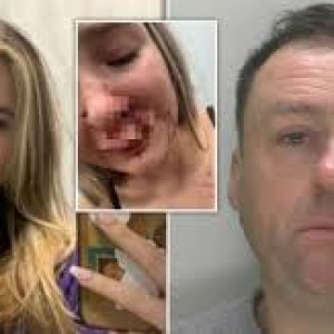 girl-19-had-her-face-bitten-off-by-stranger-on-a-bus-in-front-of-passengers